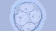 鲜胚移植失败的三大原因，鲜胚移植后需要注意的事项