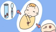 试管相关知识介绍，四川试管费用报销政策