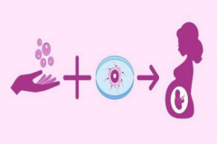 马来西亚试管治疗全貌，及精子分离术在其中的关键应用原因