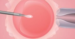 40岁女性做试管，需要取多少卵子才能怀孕？