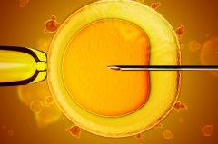 试管二代放鲜胚的流程，风险与注意事项