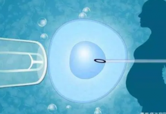 长春做二代试管选性别的费用概览及风险注意事项