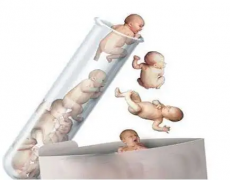 上海仁济医院三代试管费用全面预估，附带详尽供卵服务收费清单