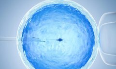 如何通过第三代试管技术选择性地生育男孩？