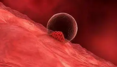 多囊不再是生育障碍？试管技术引领新希望