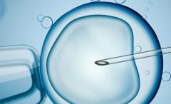 济南试管选性别费用分两种，具体详细费用解析