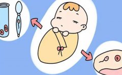 什么是试管？试管怀孕双孪生囊的几率有多高？