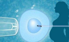 美国SCRC试管的价格差异，哪些因素会影响美国SCRC试管的费用？