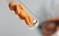 试管的费用构成，试管费用一般为3万元