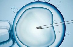 什么是卵巢功能障碍？试管对卵巢功能障碍的要求