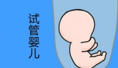 浙江权威助孕机构推荐及试管技术分析