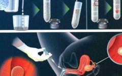 如何确定胚胎是否成功着床？影响胚胎着床的因素