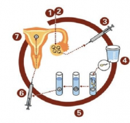试管优选医院：真伪辨别全攻略与实战指南