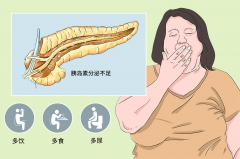 二型糖尿病也能圆父母梦！试管前必看成功小贴士！
