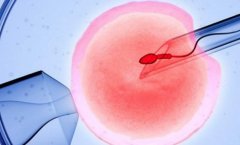 上海常见助孕项目及其费用明细，常见不孕不育治疗项目