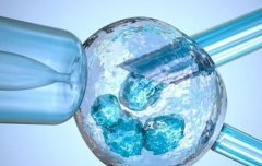 山东省妇幼保健院值得信赖，试管技术的优势有哪些？