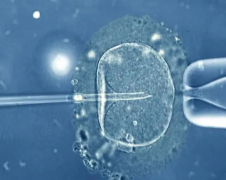 日本试管费用大起底：与全球多国价格对比，揭秘性价比之选！