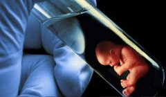 什么是完全纵膈子宫？完全纵膈子宫最常用的方法介绍