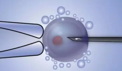 为何私立试管医院虽费用高昂，却仍是优选？