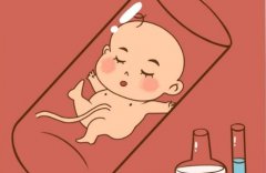 柬埔寨试管技术怎么样？有什么的优劣势？