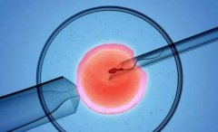 为什么选择上海工人医院进行试管？有什么优势？