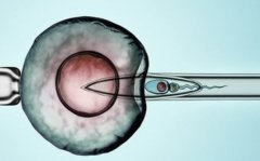 乐山三代试管包生'男'孩的正规医院详细介绍