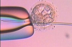 无锡市人民医院试管费用详情，费用大概需要五万元左右