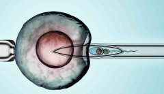 黄体功能不足做试管胚胎移植前的准备及注意事项