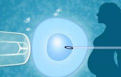 黑龙江试管费用低廉的原因及成功率分析