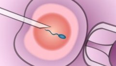 济南市妇幼保健院试管辅助技术费用及其他费用