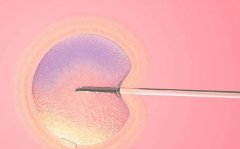 衡阳三代试管包含哪些费用？试管的成功率有多高？