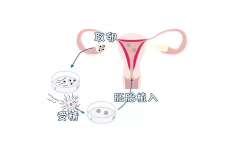 震惊！胚胎移植竟然只要1个小时？真相让你意想不到！