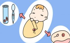 鲜胚移植失败隔一个月再移植囊胚的优势