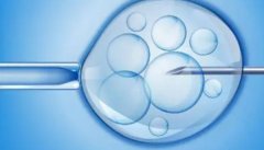 收藏！这些建议有助于高龄做试管提高卵子质量和成功率