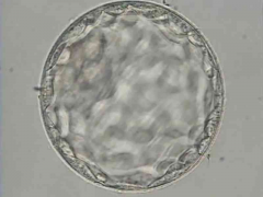 怎样知道2级5细胞的试管胚胎适不适合移植？揭秘评估胚胎质量的几个关
