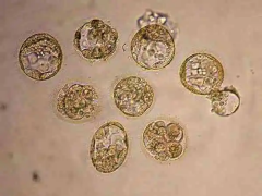 4ac囊胚能直接移植吗？解析级别与成功率，让你心中有数