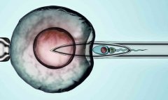 重庆三代试管的优点及操作流程，重庆三代试管龙凤胎的费用构成