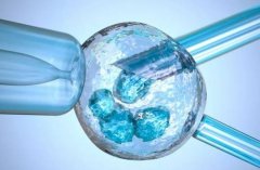 试管冷冻胚胎的优缺点，是否选择胚胎冷冻根据具体情况权衡
