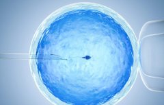 试管一促二移概况介绍，试管一促二移的具体步骤