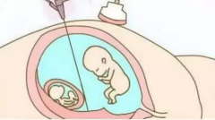 2024年重庆试管选性别，这三家医院最热门！医院排名大公开