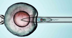 阳泉私人医院试管生'男'孩费用大公开！详细清单全掌握！