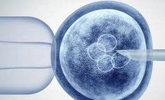 深圳私立医院试管费用：性价比高吗？