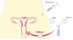 子宫内膜厚度的影响因素，如何增加子宫内膜厚度？