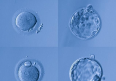 移植优质胚胎能保证百分百成功？两大问题也可能导致失败！
