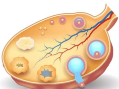 哪些原因导致空卵泡？试管促排需警惕！