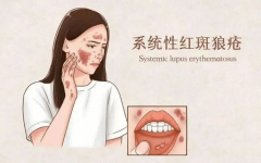 红斑狼疮做试管不受限，实现当妈妈梦想！