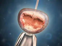 【试管促排指南】看完就懂：为什么试管一次能取那么多卵！