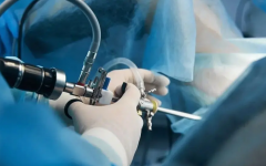 查宫腔镜有什么作用？帮助提高试管移植成功率！