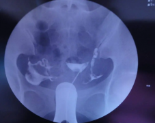 益阳必看！解决不育不孕难题，这4家生殖医院值得信赖