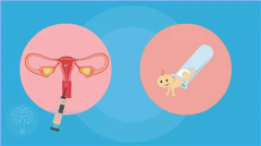 试管移植打立生素，副作用你得知道，再决定用不用！